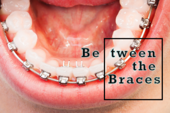 Brooklyn Dentists at Park Slope Dental Arts explain how to maintain your oral hygiene while wearing braces.