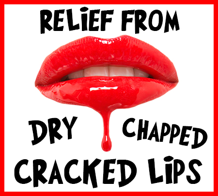 Brooklyn dentists at Park Slope Dental Arts tell you how to relieve your dry, chapped, and cracked lips!