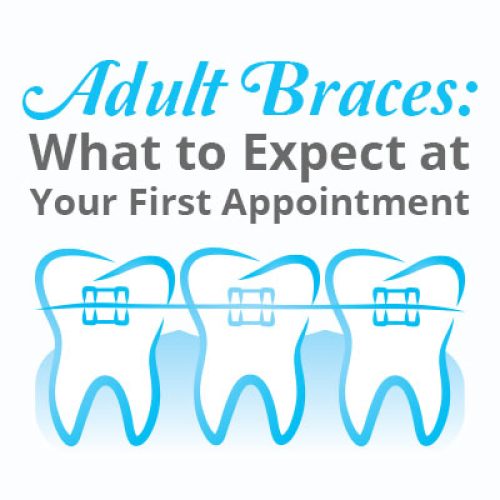 Adult Braces: What to Expect at Your First Appointment (featured image)