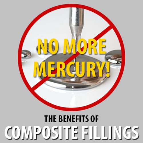 The Benefits of Composite Fillings (featured image)