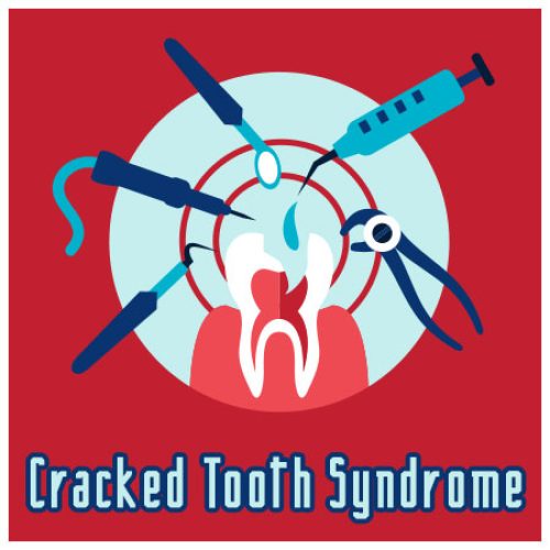 Crack Down on Cracked Tooth Syndrome (featured image)