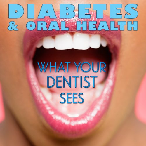 Diabetes & Oral Health: What Your Dentist Sees (featured image)