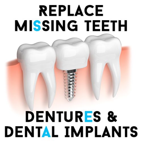 Replace Missing Teeth – Dentures & Dental Implants (featured image)