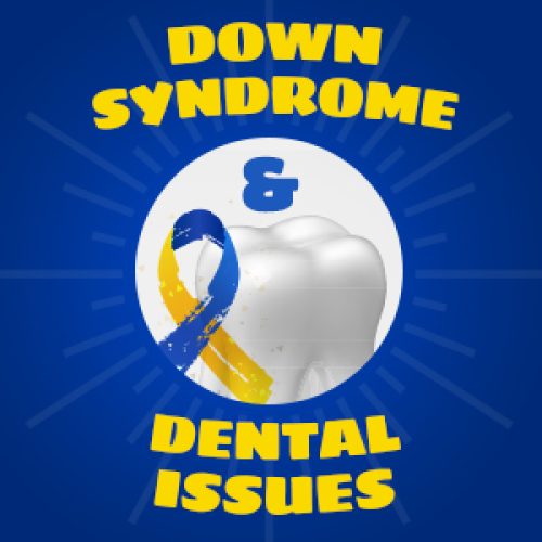 Down Syndrome & Dental Issues (featured image)