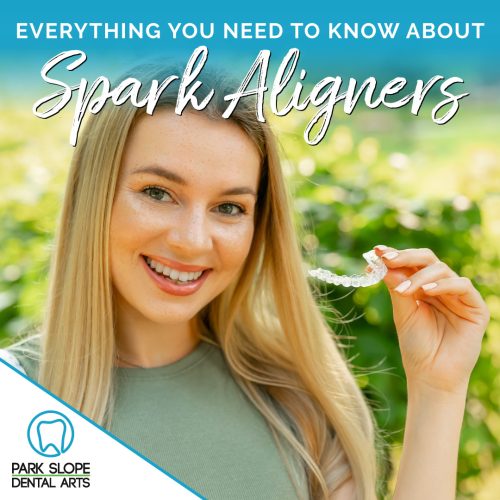 Spark Aligners® in Brooklyn: The Clear Choice for a Straighter Smile (featured image)