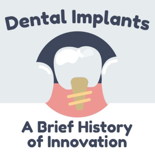 Dental Implants: A Brief History of Tooth Replacement Innovation (featured image)