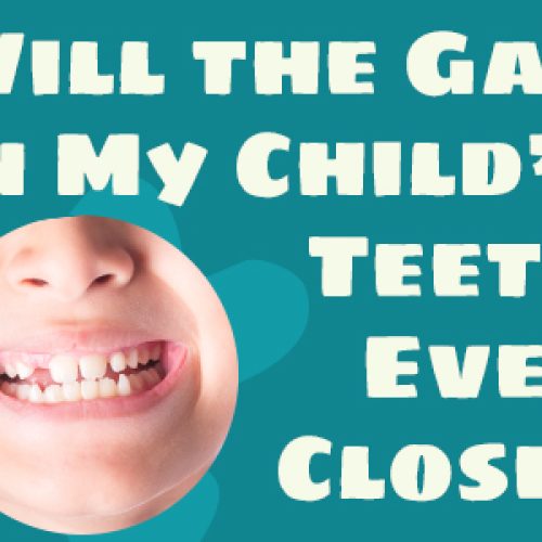 Will the Gap in My Child’s Teeth Ever Close? (featured image)