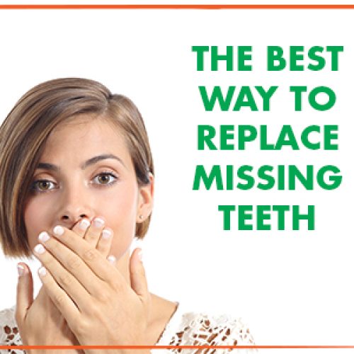 The Best Way to Replace Missing Teeth (featured image)