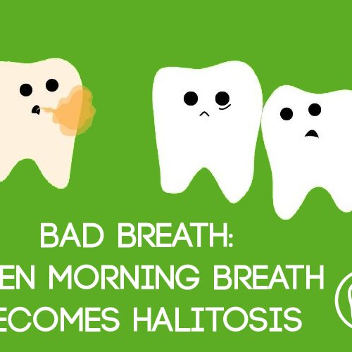 Bad Breath: When Morning Breath Becomes Halitosis (featured image)