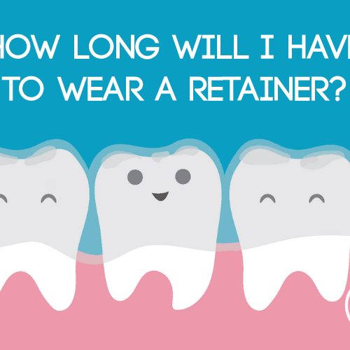 How Long Will I Have to Wear a Retainer? (featured image)