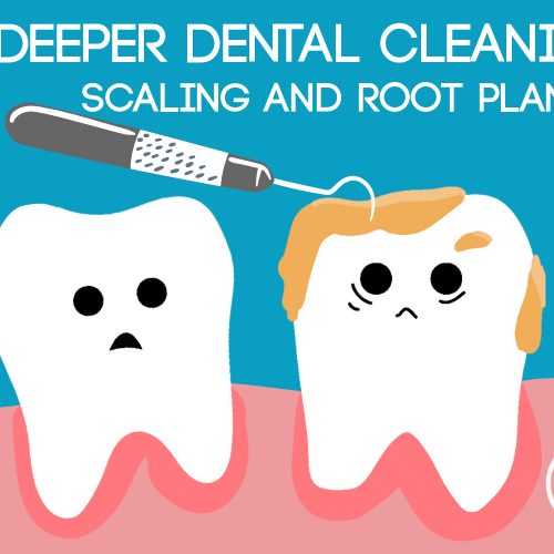 A Deeper Dental Cleaning: Scaling & Root Planing (featured image)