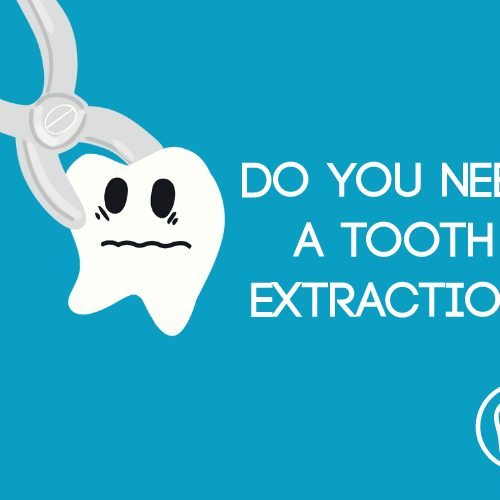 Do You Need a Tooth Extraction? (featured image)