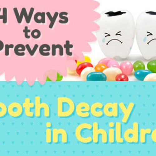 4 Ways to Prevent Tooth Decay in Children (featured image)