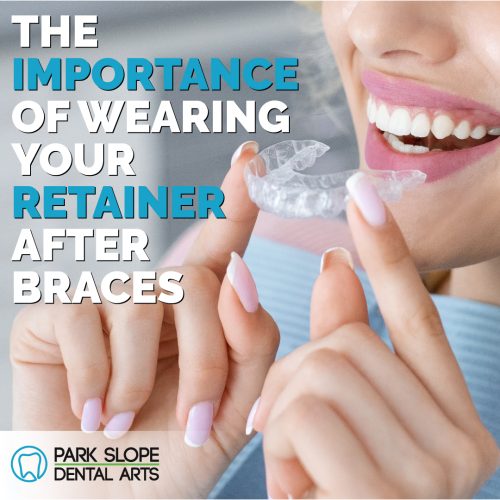 The Importance of Wearing Your Orthodontic Retainer After Braces (featured image)