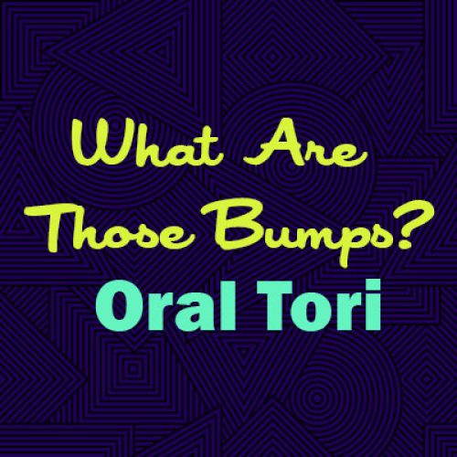 What Are Those Bumps? Oral Tori (featured image)