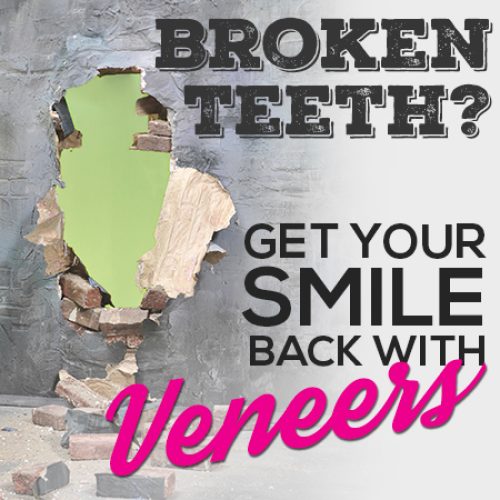 Veneers Can Give You Back Your Smile! (featured image)