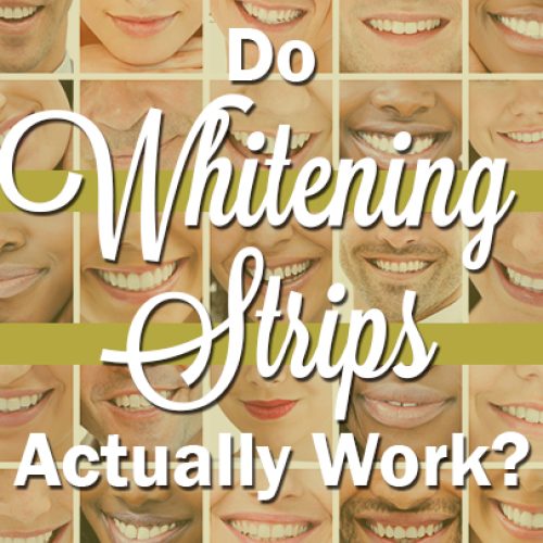 Do Whitening Strips Actually Work? (featured image)