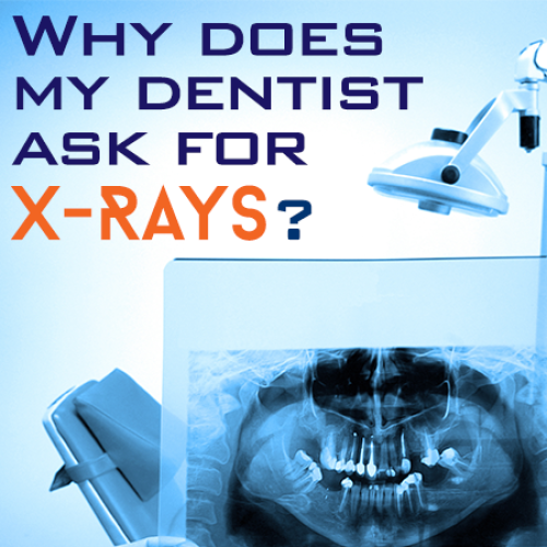 The Importance of Dental X-Rays (featured image)